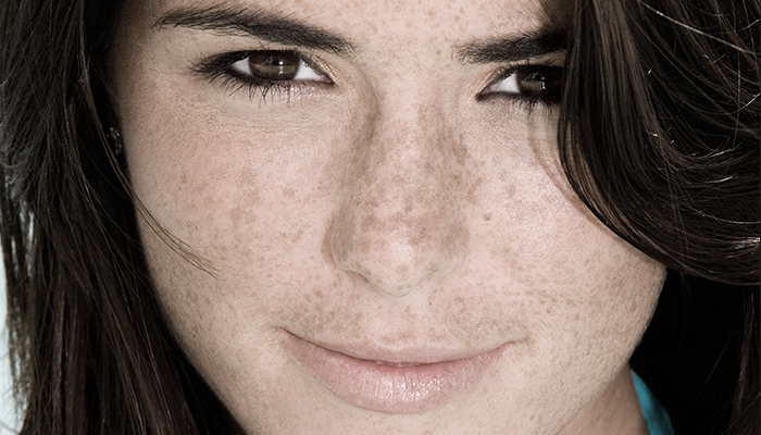 주근깨 피부 이미지